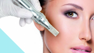 1 o 3 sesiones de tratamiento facial Dermapen, rejuvenecimiento facial de vitaminas